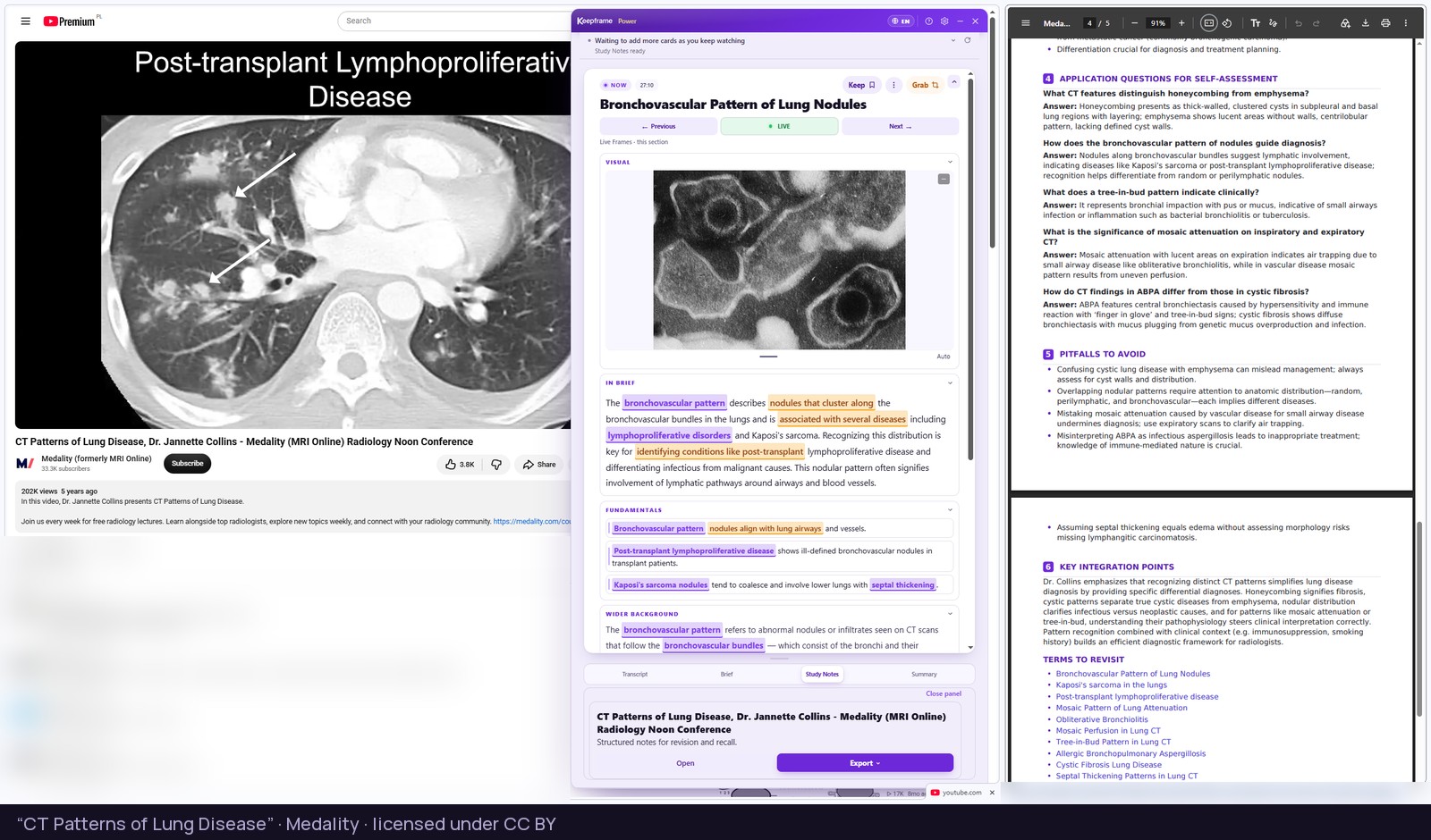 A radiology lecture on chest CT with the Keepframe panel open on Study Notes, and the exported Study Notes open beside it