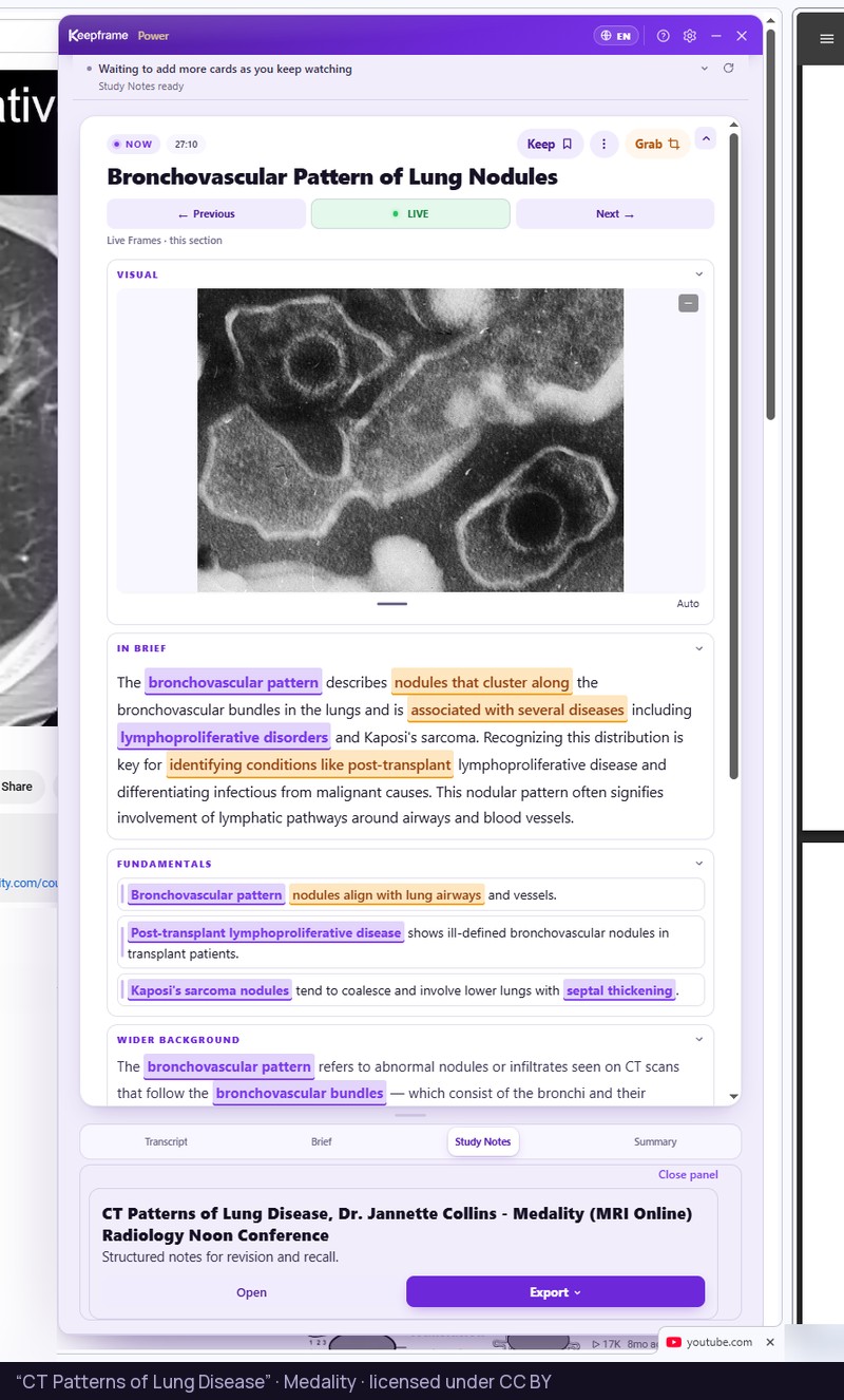 A radiology lecture on chest CT with the Keepframe panel open on Study Notes, and the exported Study Notes open beside it